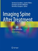 Imaging Spine After Treatment (eBook, PDF)