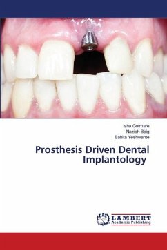Prosthesis Driven Dental Implantology