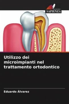 Utilizzo dei microimpianti nel trattamento ortodontico - Álvarez, Eduardo