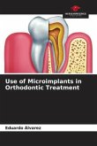 Use of Microimplants in Orthodontic Treatment
