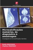 Microcalcificações mamárias, do diagnóstico à amostragem