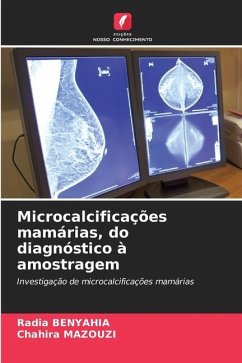 Microcalcificações mamárias, do diagnóstico à amostragem - BENYAHIA, Radia;MAZOUZI, Chahira