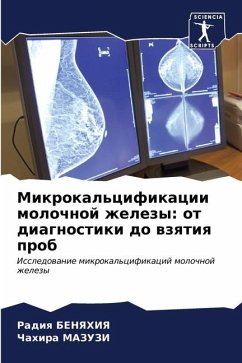 Mikrokal'cifikacii molochnoj zhelezy: ot diagnostiki do wzqtiq prob - BENYaHIYa, Radiq;MAZUZI, Chahira