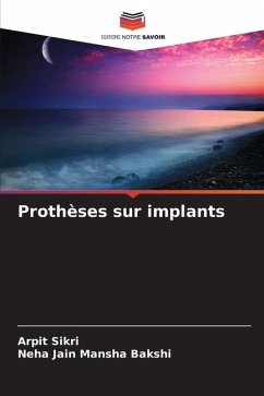 Prothèses sur implants - Sikri, Arpit;Mansha Bakshi, Neha Jain