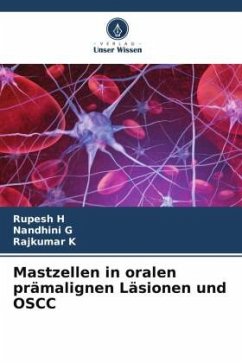 Mastzellen in oralen prämalignen Läsionen und OSCC - H, Rupesh;G, Nandhini;K, Rajkumar