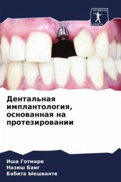 Dental'naq implantologiq, osnowannaq na protezirowanii - Gotmare, Isha;Baig, Nazish;Yeshwante, Babita