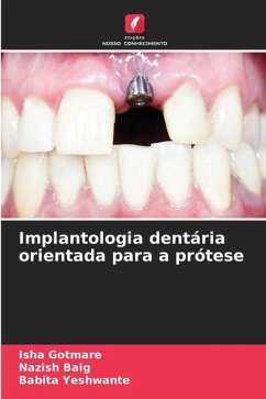 Implantologia dentária orientada para a prótese - Gotmare, Isha;Baig, Nazish;Yeshwante, Babita