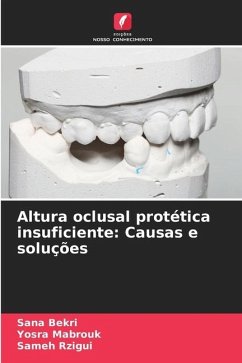 Altura oclusal protética insuficiente: Causas e soluções - Bekri, Sana;Mabrouk, Yosra;Rzigui, Sameh