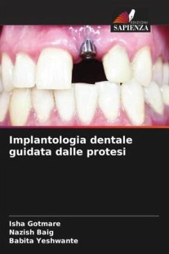 Implantologia dentale guidata dalle protesi - Gotmare, Isha;Baig, Nazish;Yeshwante, Babita