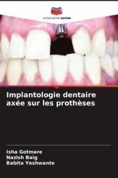 Implantologie dentaire axée sur les prothèses - Gotmare, Isha;Baig, Nazish;Yeshwante, Babita