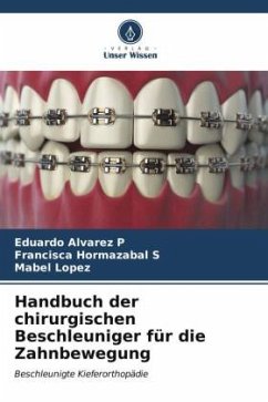 Handbuch der chirurgischen Beschleuniger für die Zahnbewegung - Alvarez P, Eduardo;Hormazabal S, Francisca;Lopez, Mabel
