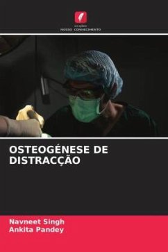 OSTEOGÉNESE DE DISTRACÇÃO - Singh, Navneet;Pandey, Ankita