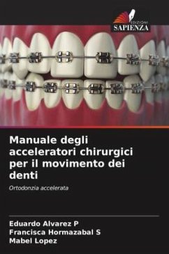 Manuale degli acceleratori chirurgici per il movimento dei denti - Alvarez P, Eduardo;Hormazabal S, Francisca;Lopez, Mabel