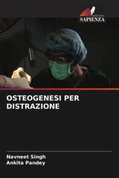 OSTEOGENESI PER DISTRAZIONE - Singh, Navneet;Pandey, Ankita