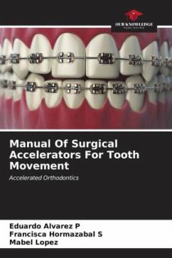 Manual Of Surgical Accelerators For Tooth Movement - Alvarez P, Eduardo;Hormazabal S, Francisca;Lopez, Mabel