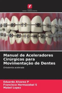 Manual de Aceleradores Cirúrgicos para Movimentação de Dentes - Alvarez P, Eduardo;Hormazabal S, Francisca;Lopez, Mabel