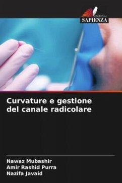 Curvature e gestione del canale radicolare - Mubashir, Nawaz;Purra, Amir Rashid;Javaid, Nazifa