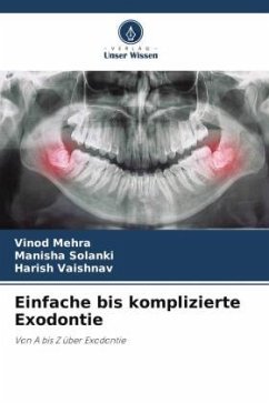 Einfache bis komplizierte Exodontie - Mehra, Vinod;Solanki, Manisha;VAISHNAV, HARISH