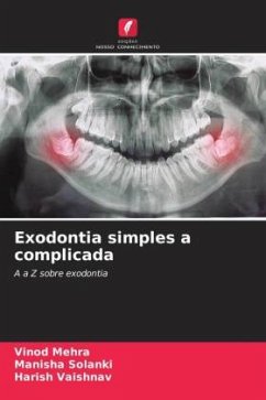 Exodontia simples a complicada - Mehra, Vinod;Solanki, Manisha;VAISHNAV, HARISH