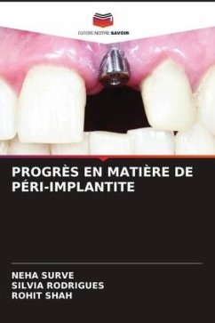 PROGRÈS EN MATIÈRE DE PÉRI-IMPLANTITE - SURVE, NEHA;Rodrigues, Silvia;Shah, Rohit