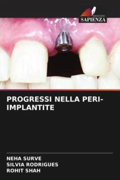 PROGRESSI NELLA PERI-IMPLANTITE - SURVE, NEHA;Rodrigues, Silvia;Shah, Rohit