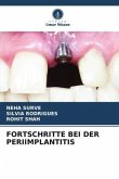 FORTSCHRITTE BEI DER PERIIMPLANTITIS