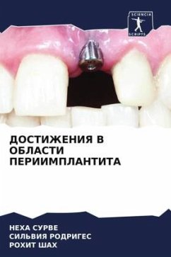 DOSTIZhENIYa V OBLASTI PERIIMPLANTITA - SURVE, NEHA;Rodriges, Sil'wiq;Shah, Rohit