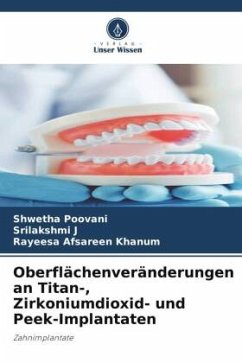 Oberflächenveränderungen an Titan-, Zirkoniumdioxid- und Peek-Implantaten - Poovani, Shwetha;J, Srilakshmi;Khanum, Rayeesa Afsareen