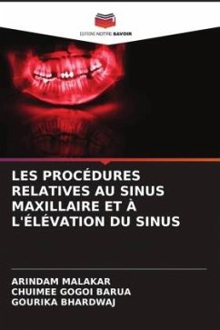 LES PROCÉDURES RELATIVES AU SINUS MAXILLAIRE ET À L'ÉLÉVATION DU SINUS - Malakar, Arindam;Barua, Chuimee Gogoi;BHARDWAJ, GOURIKA