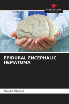 EPIDURAL ENCEPHALIC HEMATOMA - Daoud, Souad