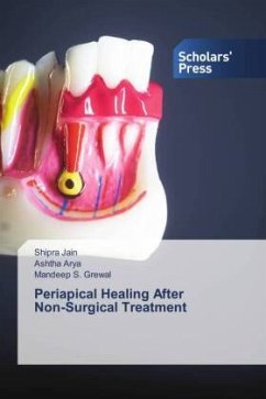 Periapical Healing After Non-Surgical Treatment - Jain, Shipra;Arya, Ashtha;Grewal, Mandeep S.