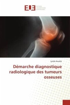 Démarche diagnostique radiologique des tumeurs osseuses - Aoudia, Lynda