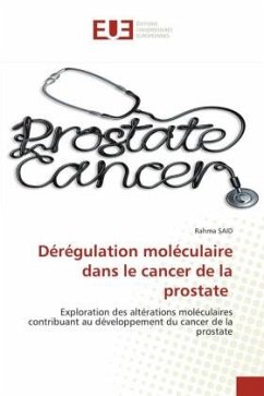 Dérégulation moléculaire dans le cancer de la prostate - SAID, Rahma
