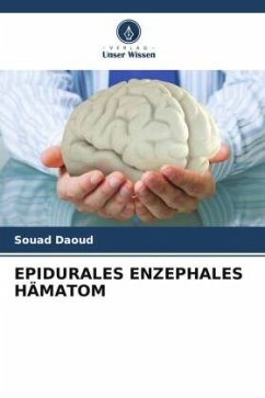 EPIDURALES ENZEPHALES HÄMATOM - Daoud, Souad