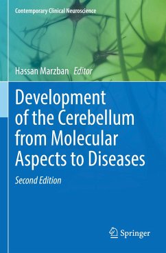 Development of the Cerebellum from Molecular Aspects to Diseases