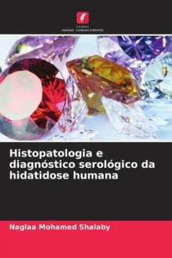 Histopatologia e diagnóstico serológico da hidatidose humana - Shalaby, Naglaa Mohamed