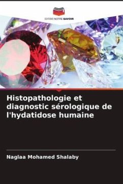 Histopathologie et diagnostic sérologique de l'hydatidose humaine - Shalaby, Naglaa Mohamed