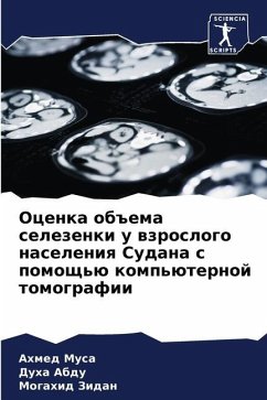 Ocenka ob#ema selezenki u wzroslogo naseleniq Sudana s pomosch'ü komp'üternoj tomografii - Musa, Ahmed;Abdu, Duha;Zidan, Mogahid