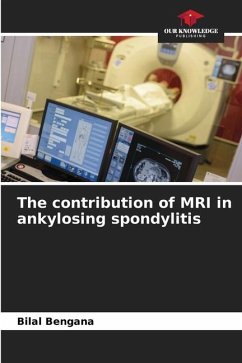The contribution of MRI in ankylosing spondylitis - Bengana, Bilal