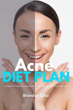 Cover Acne Diet Plan