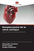Remplacement de la valve aortique