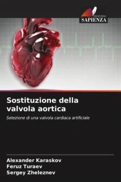 Sostituzione della valvola aortica - Karaskov, Alexander;Turaev, Feruz;Zheleznev, Sergey