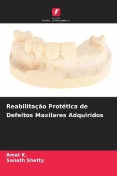 Reabilitação Protética de Defeitos Maxilares Adquiridos - K., Amal;Shetty, Sanath