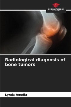 Radiological diagnosis of bone tumors - Aoudia, Lynda