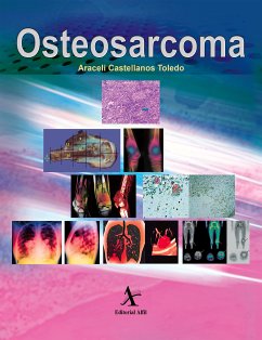 Osteosarcoma (eBook, PDF) - Castellanos Toledo, Araceli; Martínez Ávalos, Armando B.; Rodríguez Jurado, Rodolfo R.