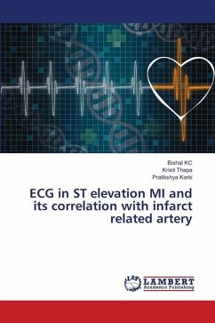 ECG in ST elevation MI and its correlation with infarct related artery - KC, Bishal;Thapa, Kristi;Karki, Pratikshya