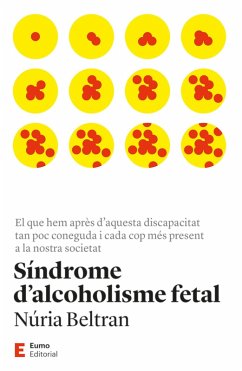 Cover Síndrome d'alcoholisme fetal (eBook, ePUB)