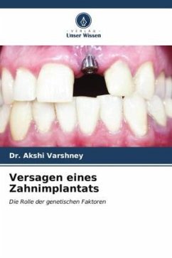 Versagen eines Zahnimplantats - Varshney, Dr. Akshi