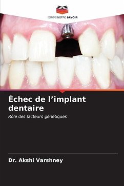 Échec de l¿implant dentaire - Varshney, Dr. Akshi