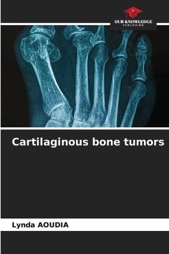 Cartilaginous bone tumors - Aoudia, Lynda